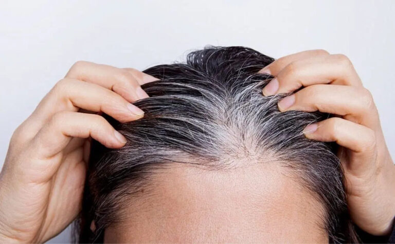 Remedio casero para eliminar las canas