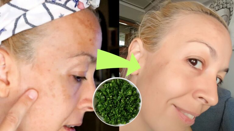 Elimina las manchas faciales con perejil