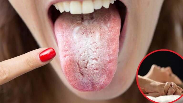 Consejos para prevenir el virus del papiloma humano